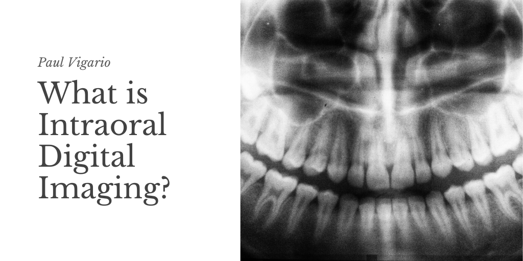 Paul Vigario — Connecticut — What Is Intraoral Digital Imaging