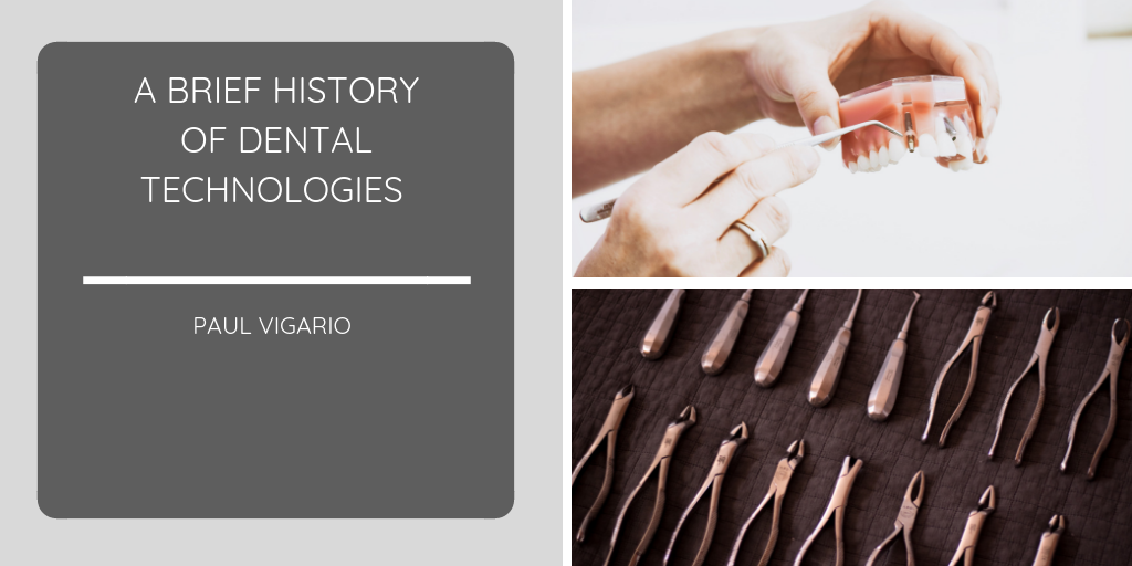 A Brief History of Dental Technologies