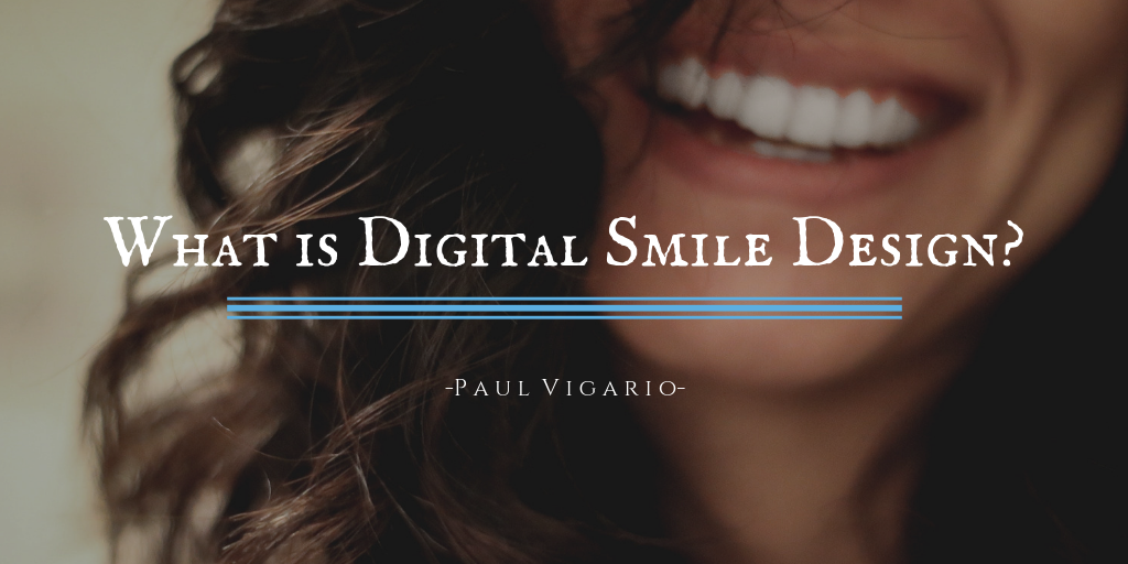 What Is Digital Smile Design
